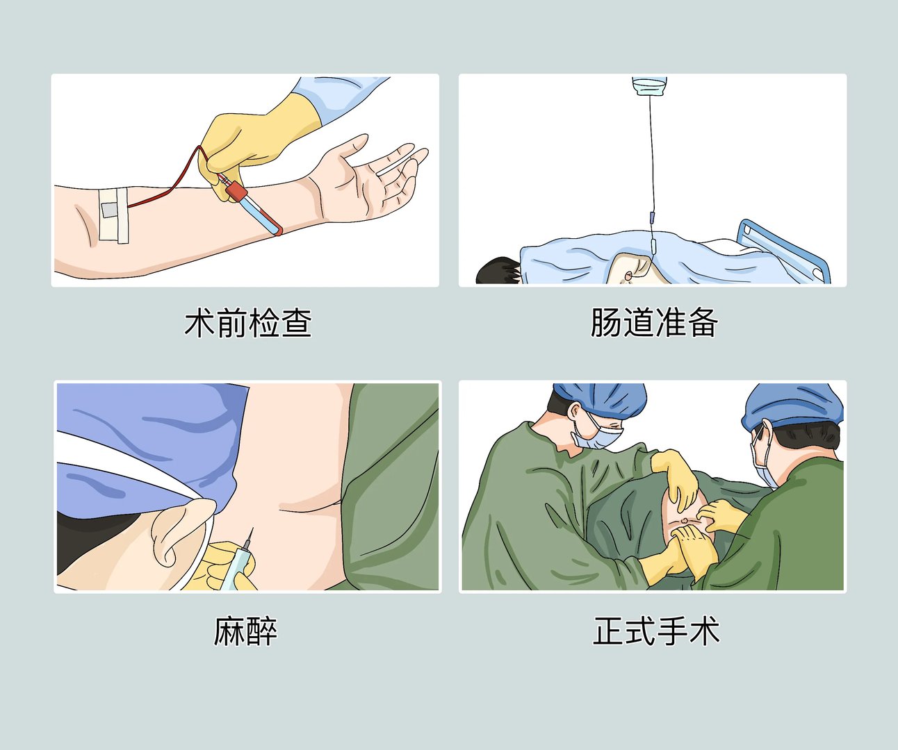 做痔疮手术的流程