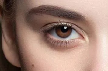 杭州一般做双眼皮多少钱