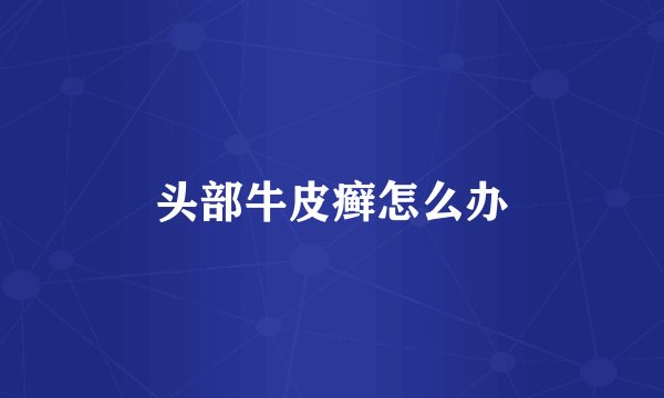 头部牛皮癣怎么办