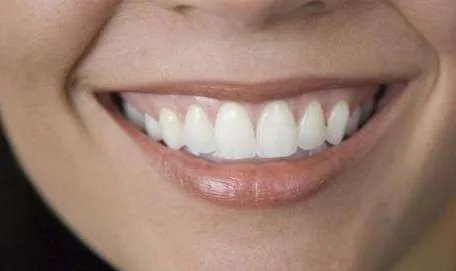 牙齿美白的价格多少