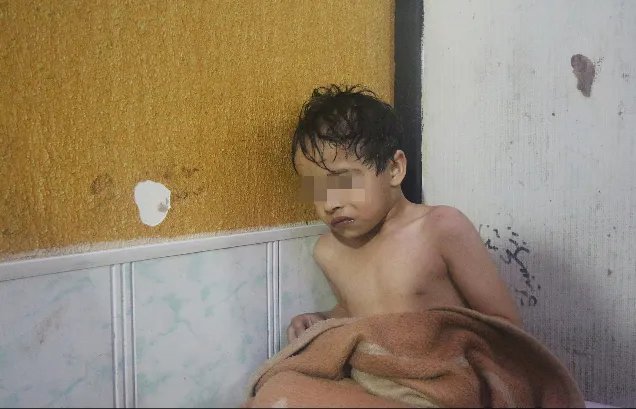 叙利亚疑遭大规模毒气攻击伤亡情况如何？