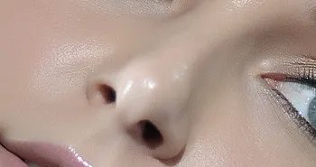 驼峰鼻整形效果怎样