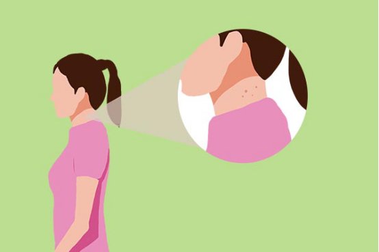 淋巴结肿瘤怎么治