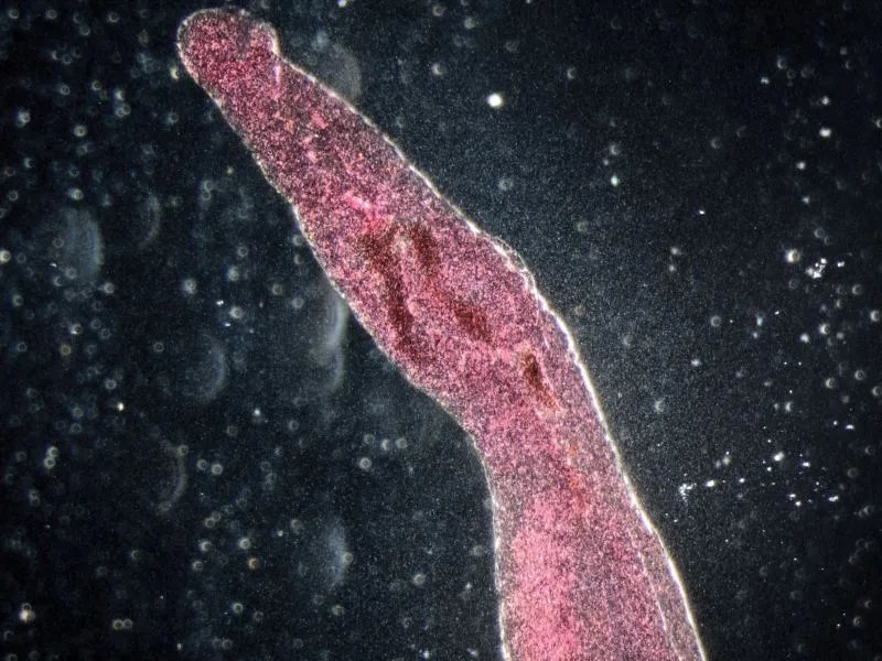 什么是血吸虫病