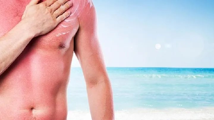 脸上有黄褐斑是怎么引起的