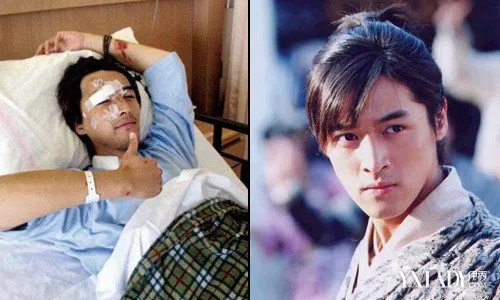 胡歌出车祸的原因分析胡歌车祸前后照片曝光