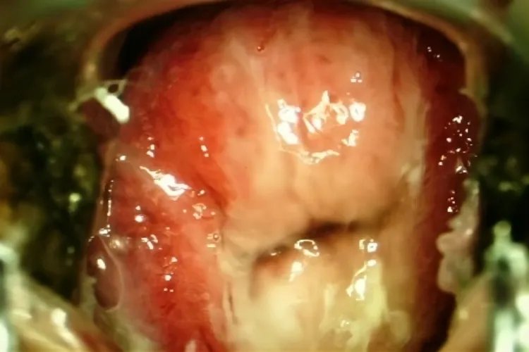 什么是纳囊的图片大全