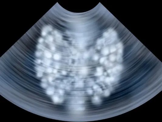 吃什么可以防辐射