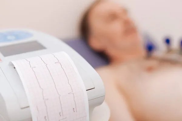 心肌梗塞是什么原因引起的 心肌梗塞的病因有哪些