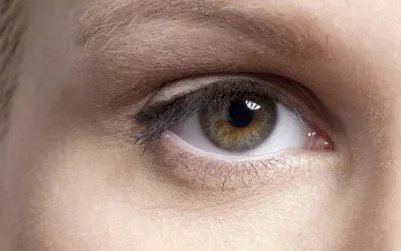 眼袋手术费用要多少