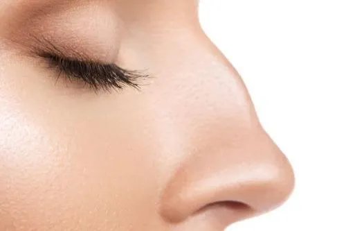 先天性鼻子畸形图片