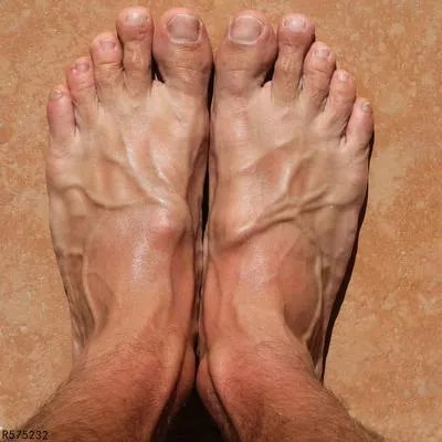 青筋明显是什么原因造成的