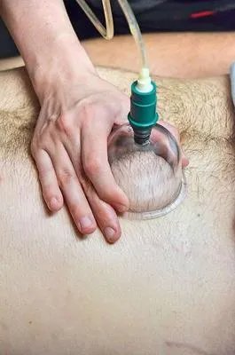 治疗荨麻疹的小偏方是什么