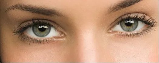 眼袋整形术注意的事项