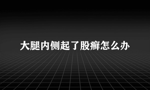 大腿内侧起了股癣怎么办