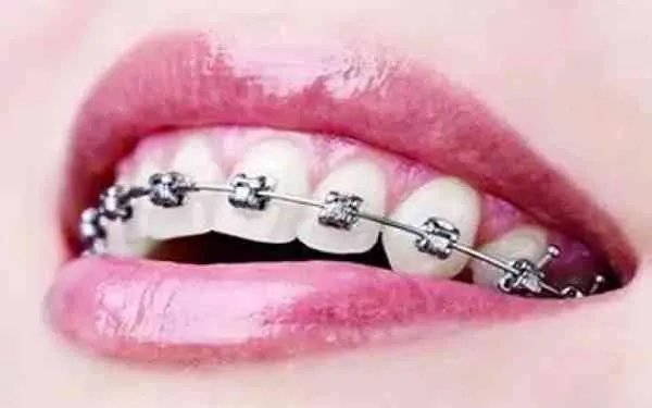 郑州哪个医院做牙科专业?究竟需要多少费用呢