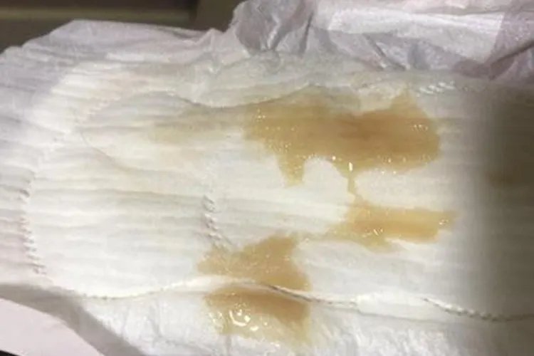 月经第七天流黄水图片