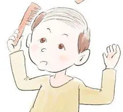 脱发严重怎么办