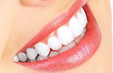 上海种植牙多少钱