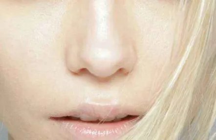 鼻翼缩小整形要多少钱