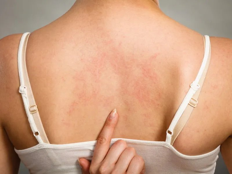 身上长小红点很痒是怎么回事