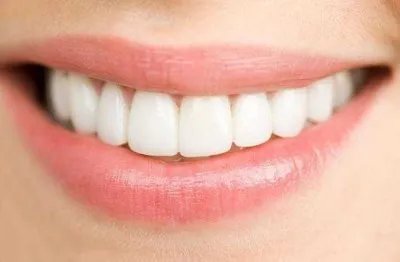 美白牙齿价格是多少