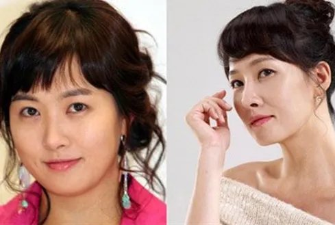 惊爆金善雅整容?    网友称更喜欢她性格