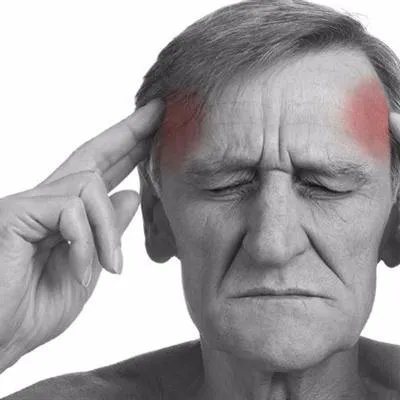 斑秃偏方有哪些