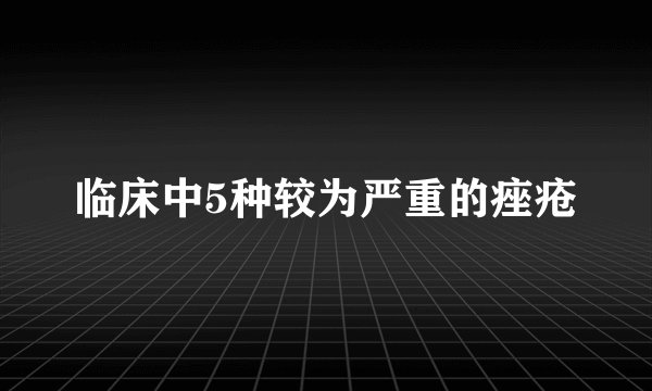 临床中5种较为严重的痤疮