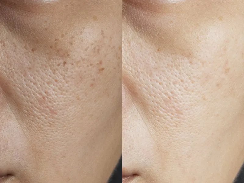 黑脸娃娃的作用和功效