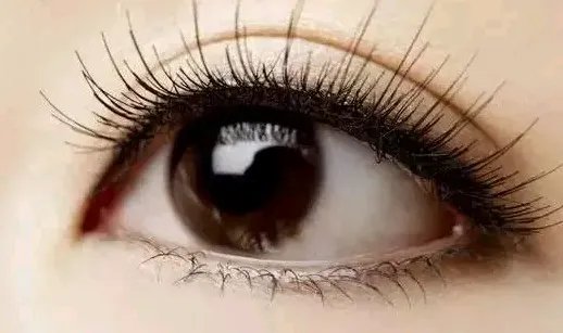 双眼皮修复前后图片