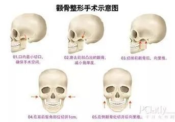 为什么很多人觉得周扬青配不上罗志祥？