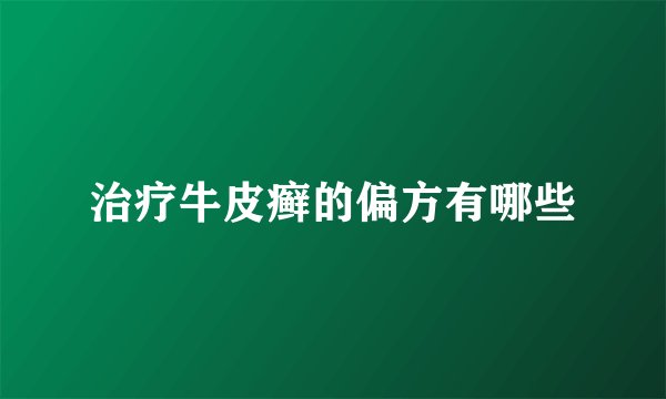 治疗牛皮癣的偏方有哪些
