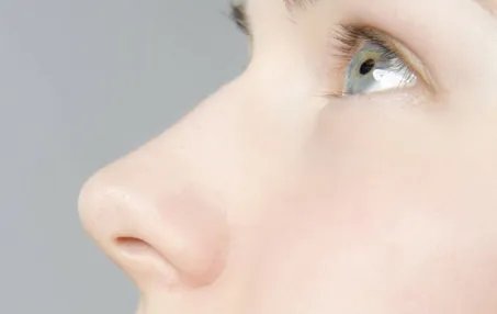 缩鼻头手术怎么做