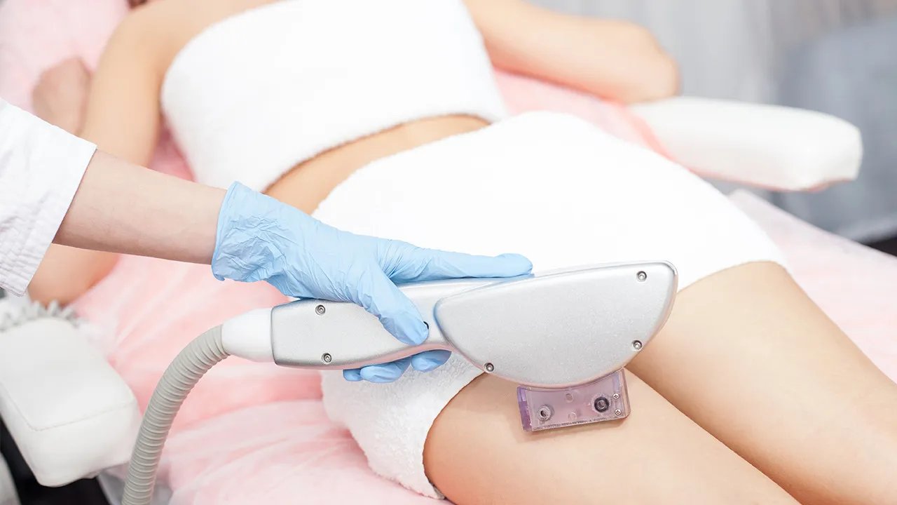 激光脱毛的原理