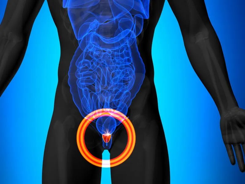 前列宝康可以治疗前列腺炎吗