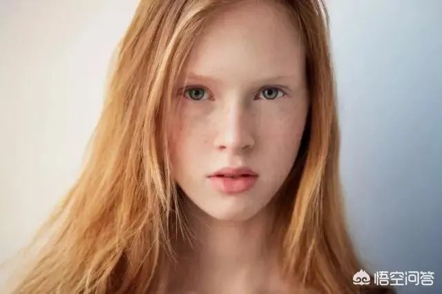 激光祛斑真的有效吗？