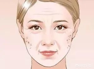 激光祛斑真的有效吗？