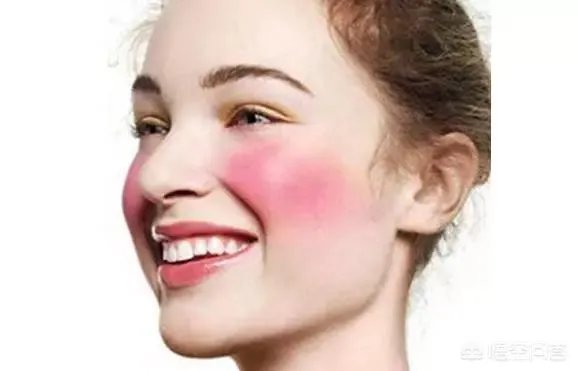 激光祛斑真的有效吗？