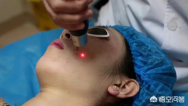 激光祛斑真的有效吗？