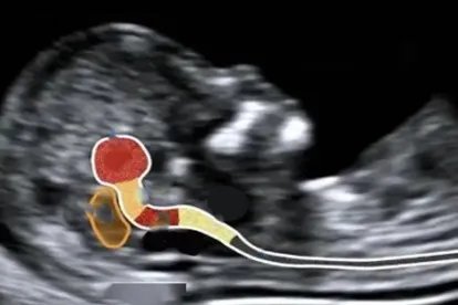 正常胎儿颅内结构图