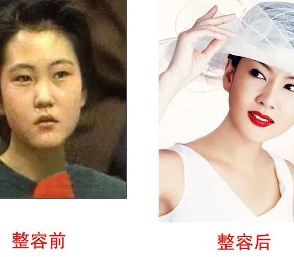 【图】金南珠整容前后 简直判若两人