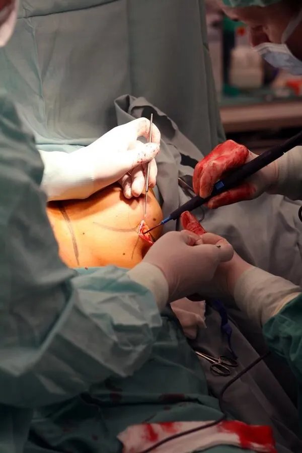 喝什么奶可以丰胸