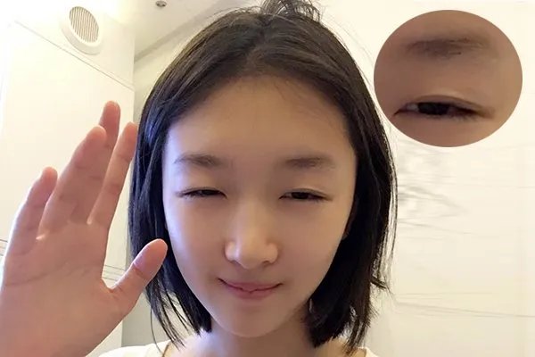 单眼皮的周冬雨也很火,为什么现在的大众还是喜欢双眼皮大眼睛?