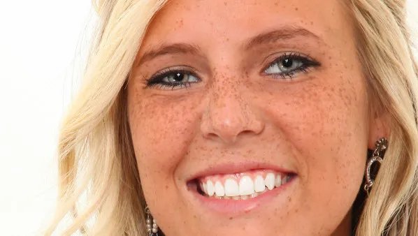 怎样去除脸上老年斑