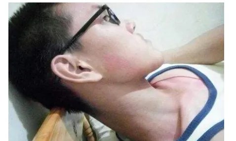 鞋拔子脸是什么?