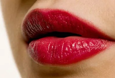 注射玻尿酸丰唇的相关内容