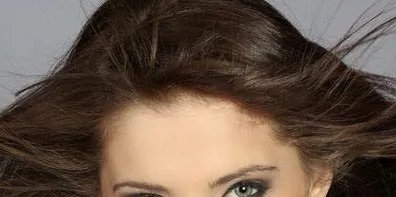 头发种植术哪家医院好