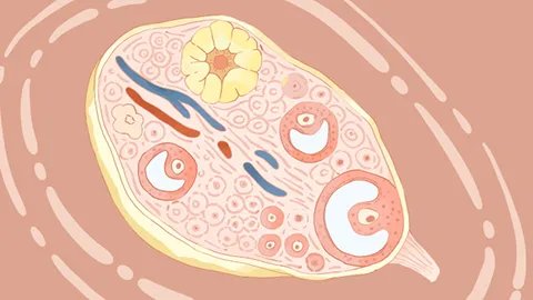 巧克力卵巢囊肿如何治疗