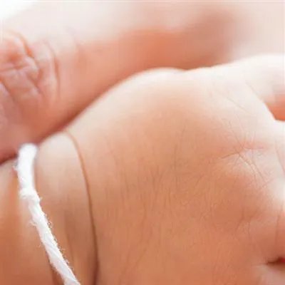 鱼鳞病初期图片